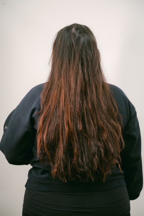 before a treatment